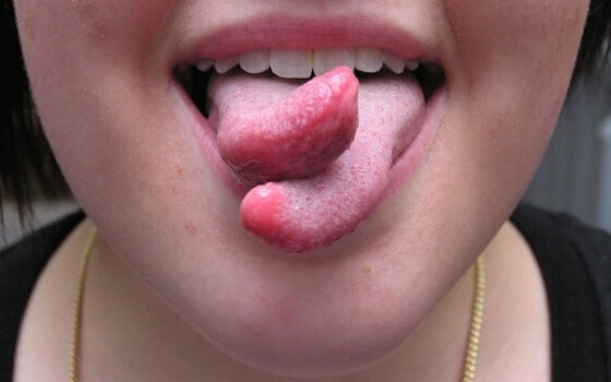 23 câu líu lưỡi cải thiện giọng nói một cách hiệu quả nhất